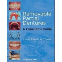 Image of Removable Partial Dentures : A Clinician's Guide