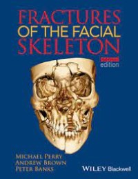 Image of Fractures Of The Facial Skeleton (e-Book FKG)