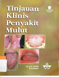 Tinjauan Klinis Penyakit Mulut