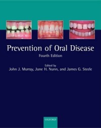 The Prevention Of Oral Disease