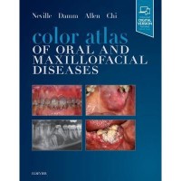 Image of Color Atlas Of Oral And Maxillofacial Diseases