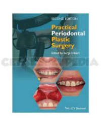 Image of Practical Periodontal Plastic Surgery
