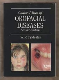 Image of A Colour Atlas Of Oro-Facial Diseases