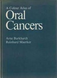 Image of A Colour Atlas Of Oral Cancers