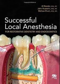 Image of Successful Local Anesthesia : For Restorative Dentistry And Endodontics
