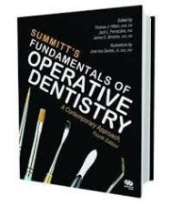 Image of Summit's Fundamentals Of Operative Dentistry : A Contemporary Approach