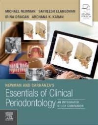 Image of Newman And Carranza's Essentials Of Clinical Periodontology : An Integrated Study Companion