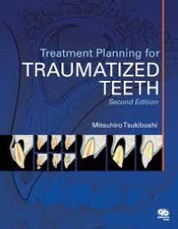 Treatment Planning For Traumatized Teeth